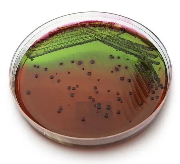 Eosin Methylene Blue Agar Plates